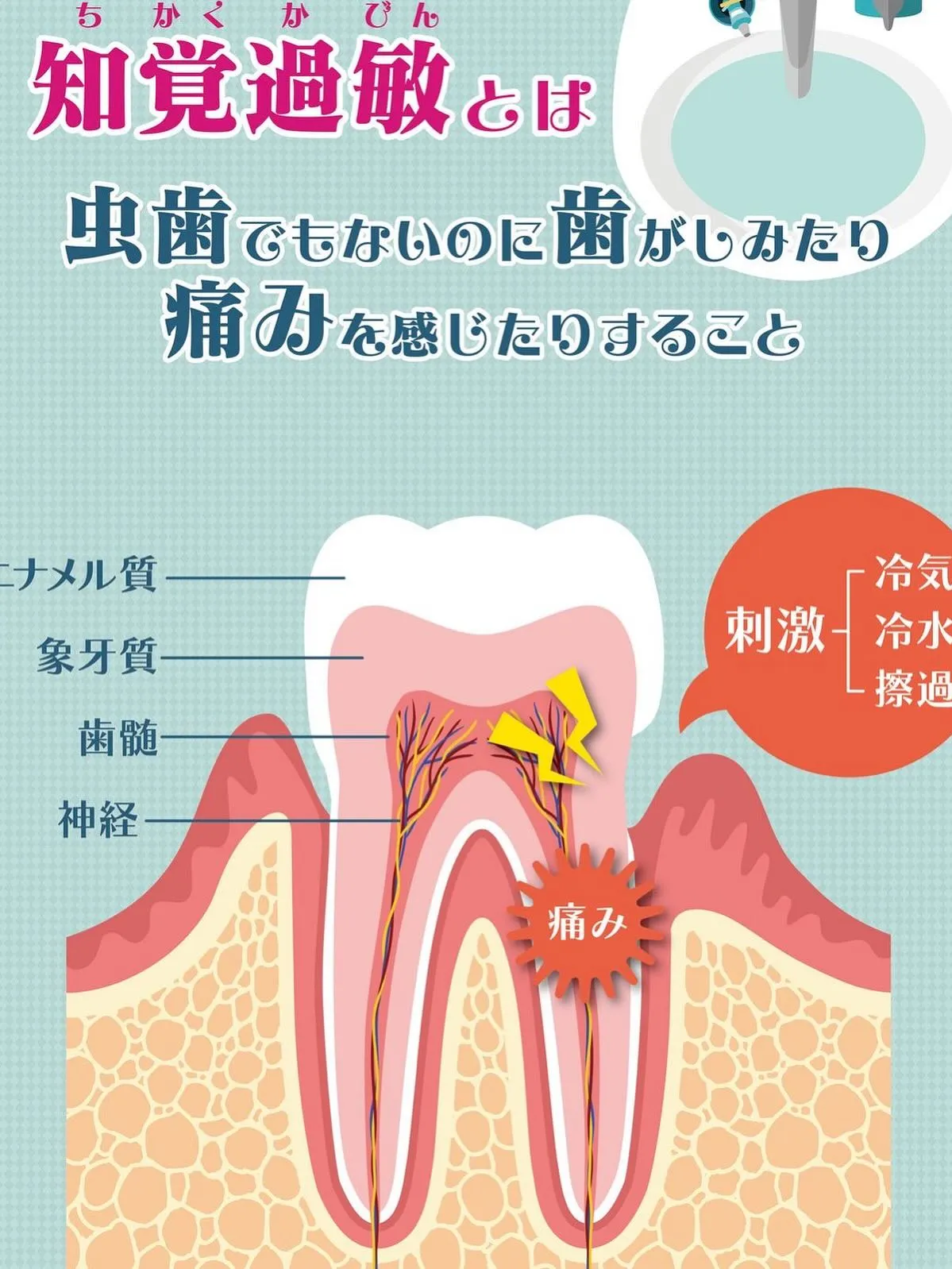 知覚過敏⟡