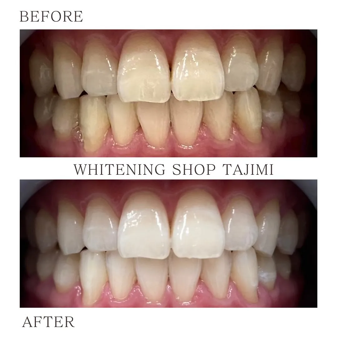Before→After⟡