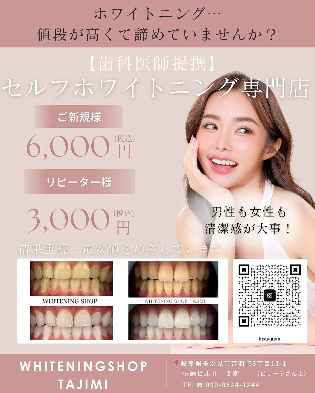 ホワイトニングをもっと身近に˖ ࣪⊹