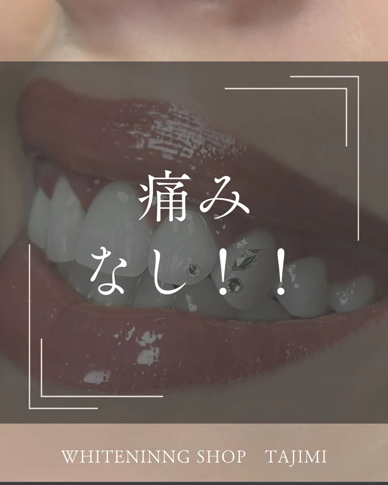 当店のホワイトニングは痛みなし˖ ࣪⊹