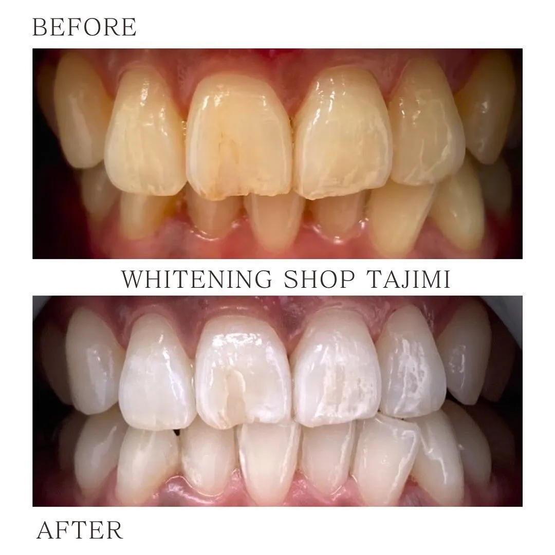 回数を重ねるごとにトーンアップ✨