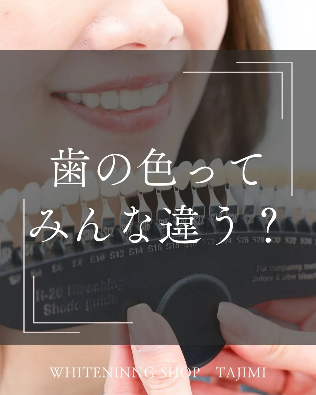 歯の色ってみんな違う?