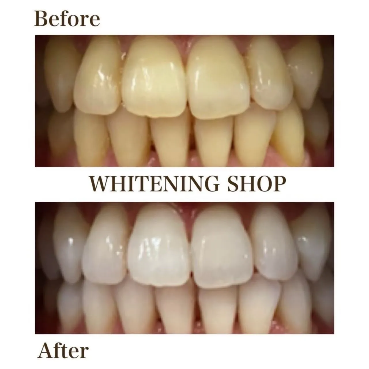 実は着色汚れがあるかも？