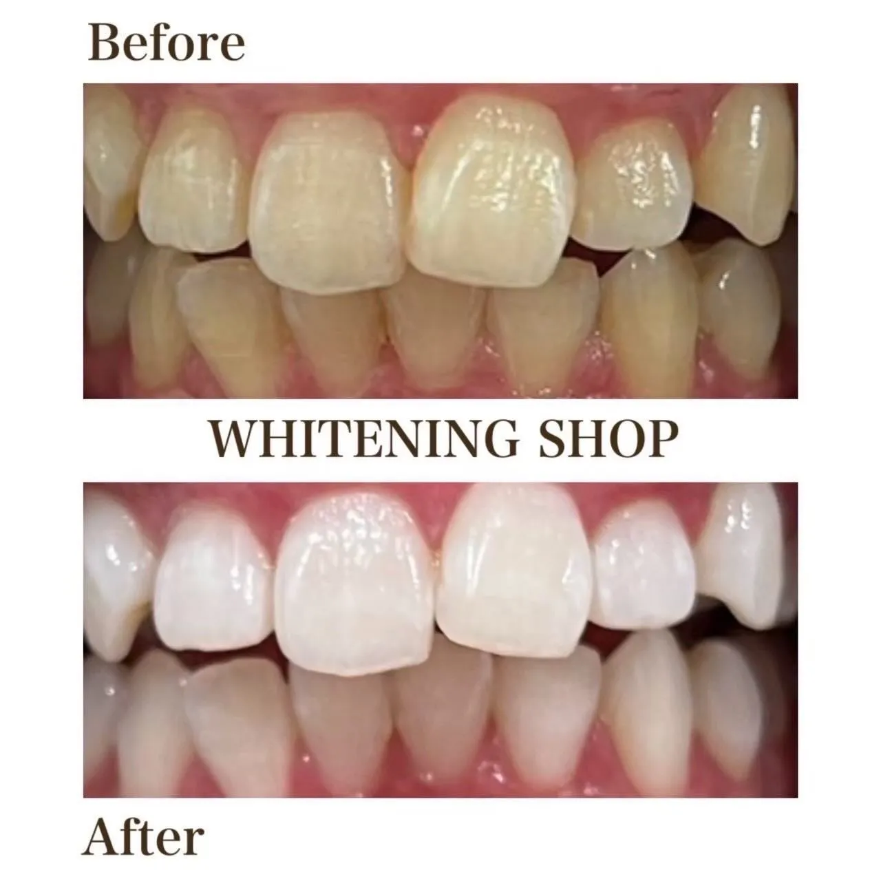 塗布のポイント☝️✨