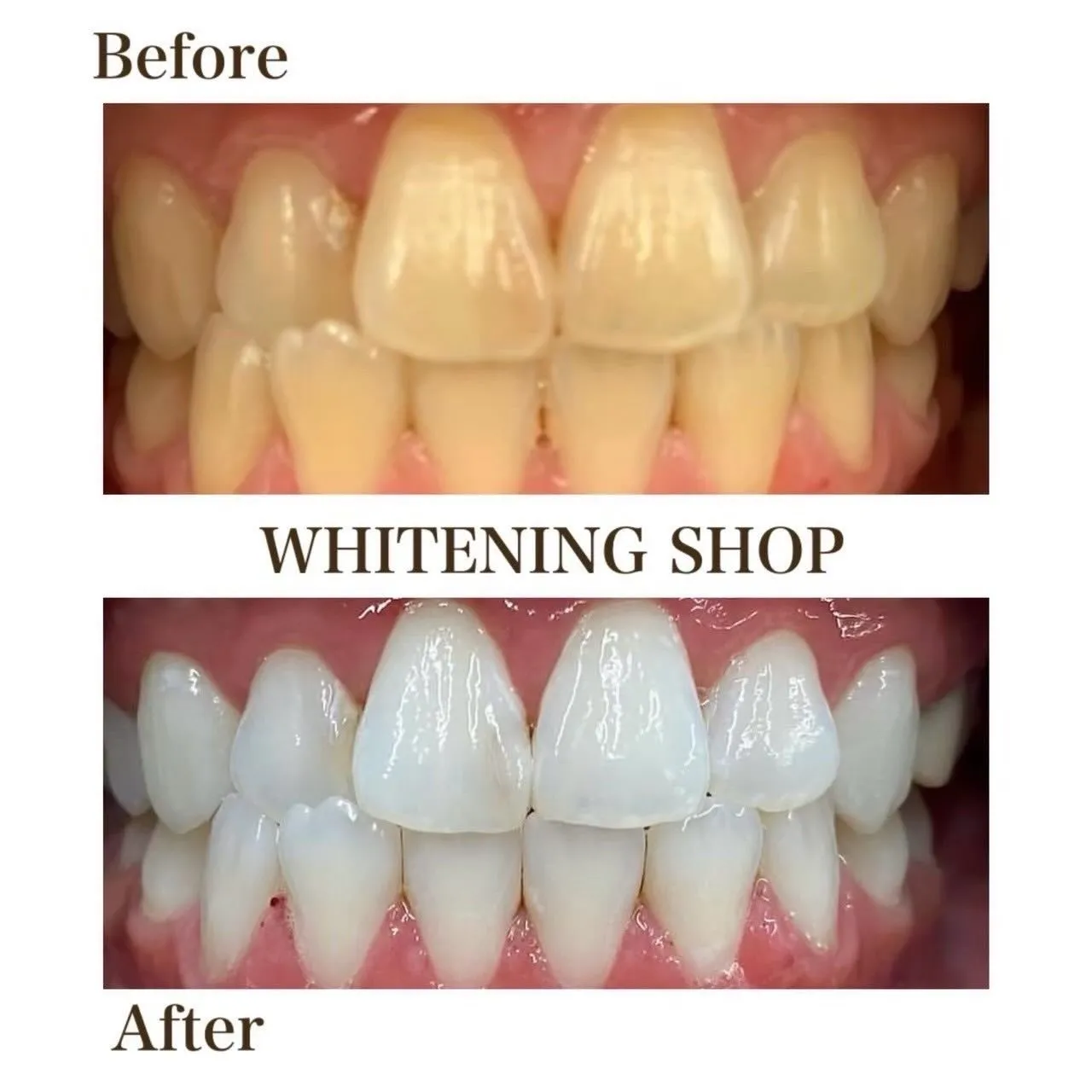 歯の印象で、笑顔は変わる🦷✨