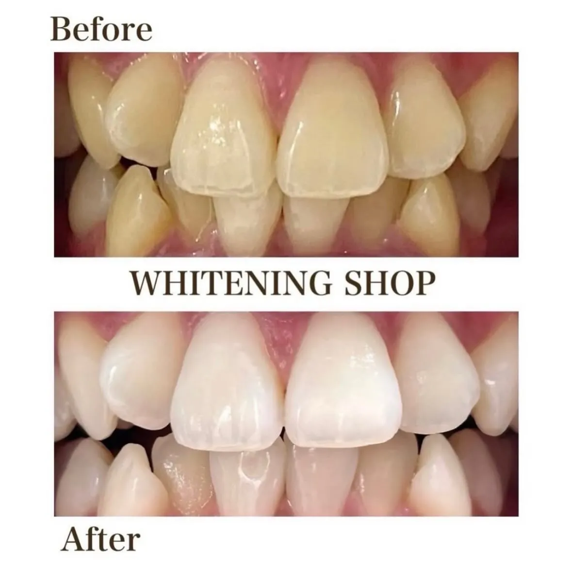 鏡でチェックしてみてください🦷