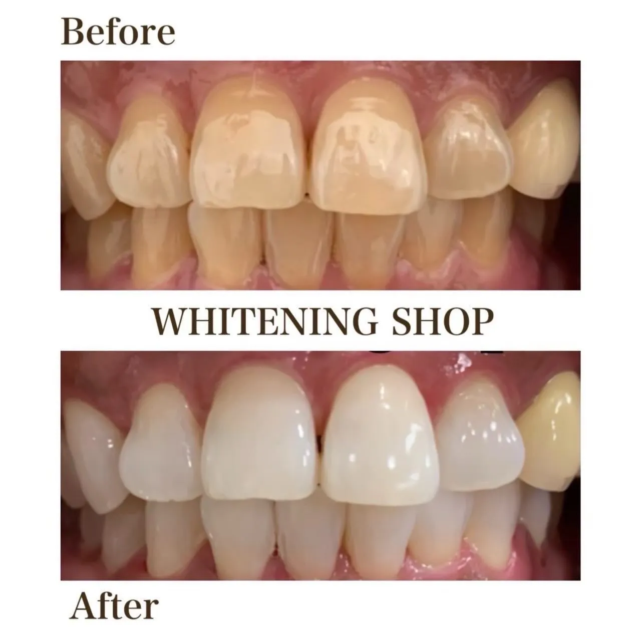 マスク外して、自信ある？😏